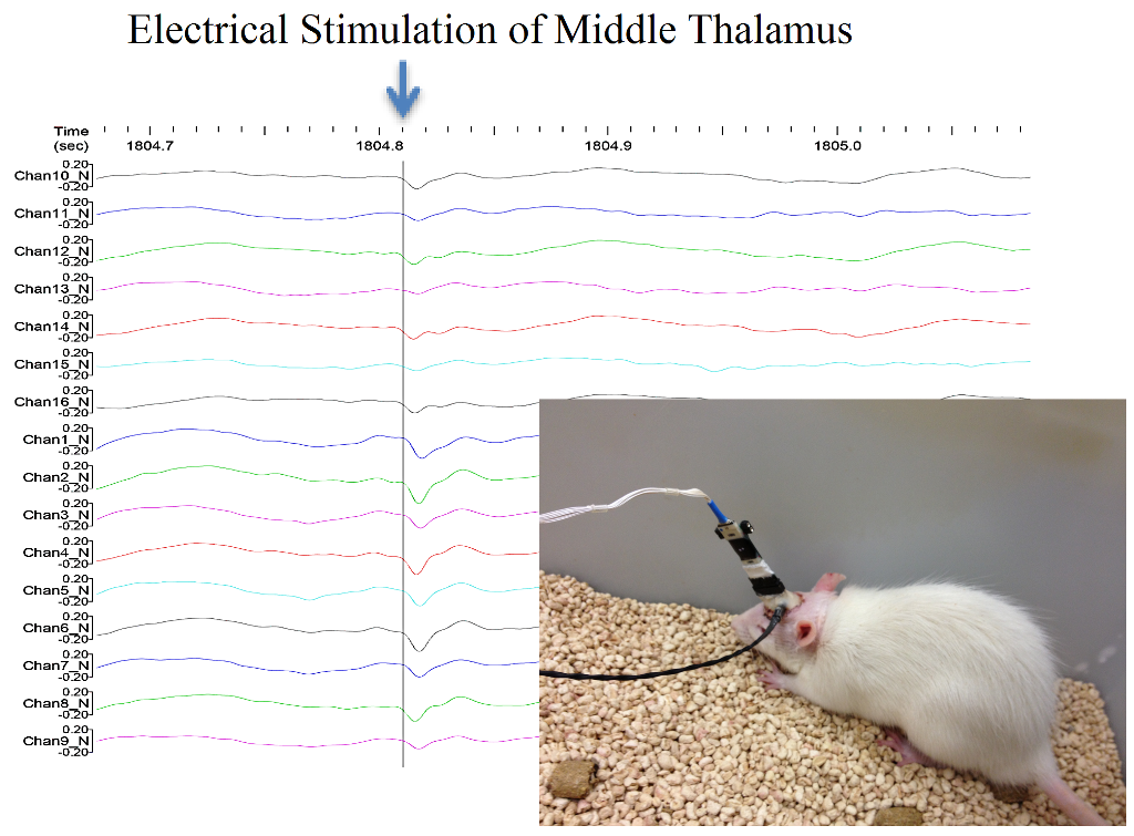 Neural Probe Project