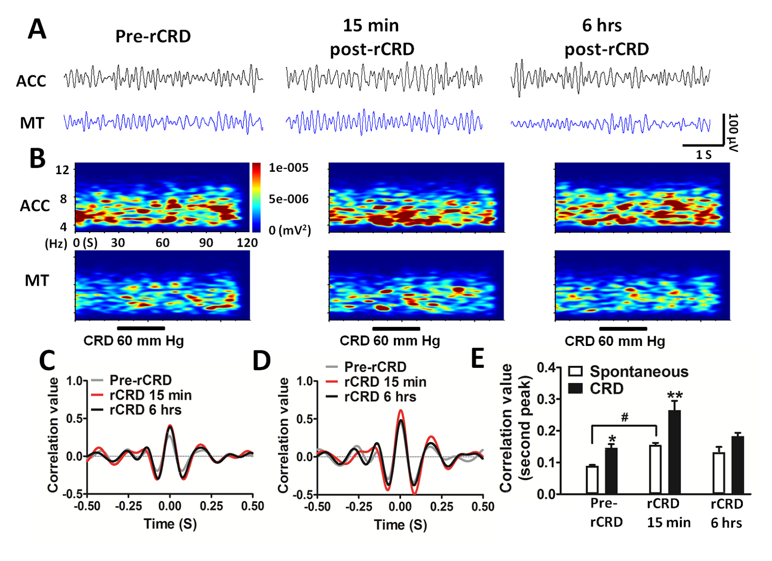 Perceptual Visceral Pain Learning